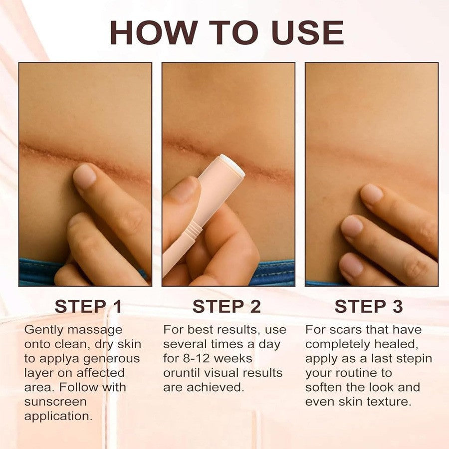 NovaCart Silicone Scar Stick